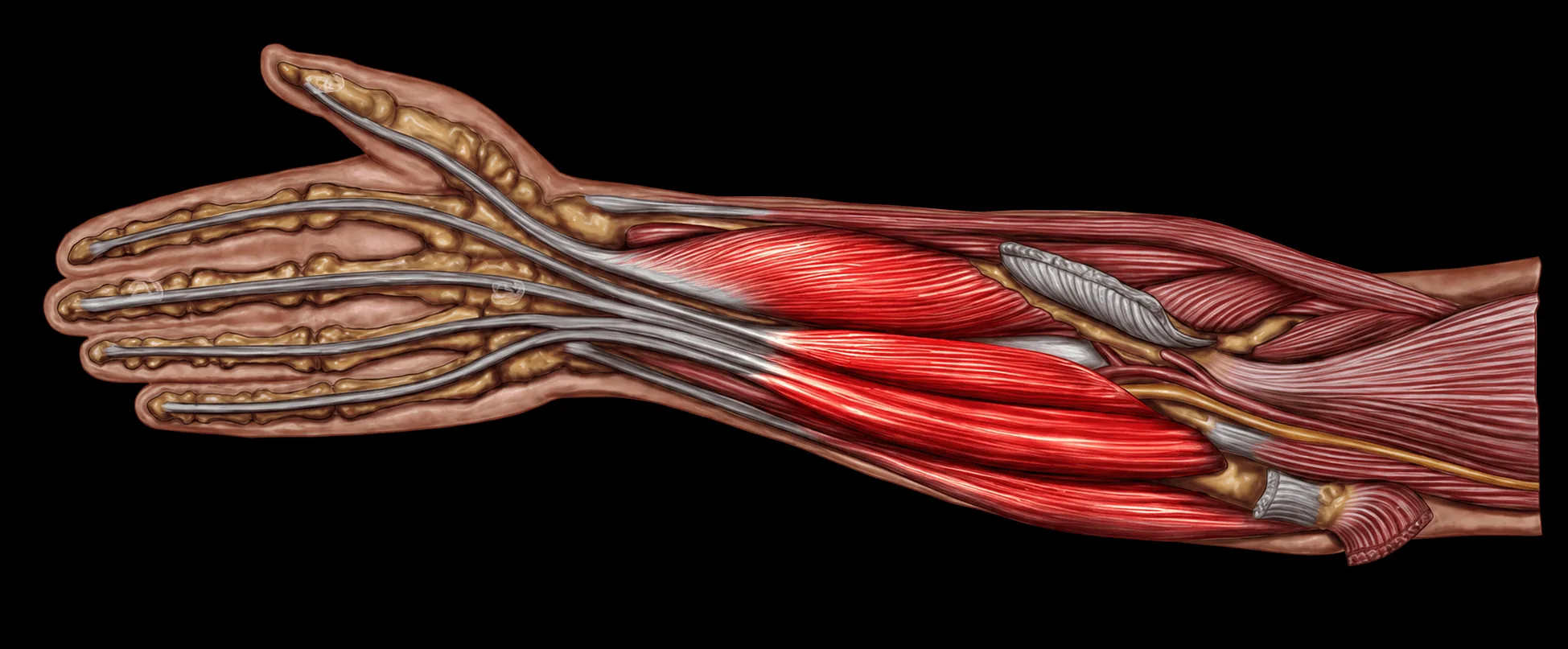 Les muscles fléchisseurs du poignet et des doigts mis en évidence en rouge sur l'avant-bras